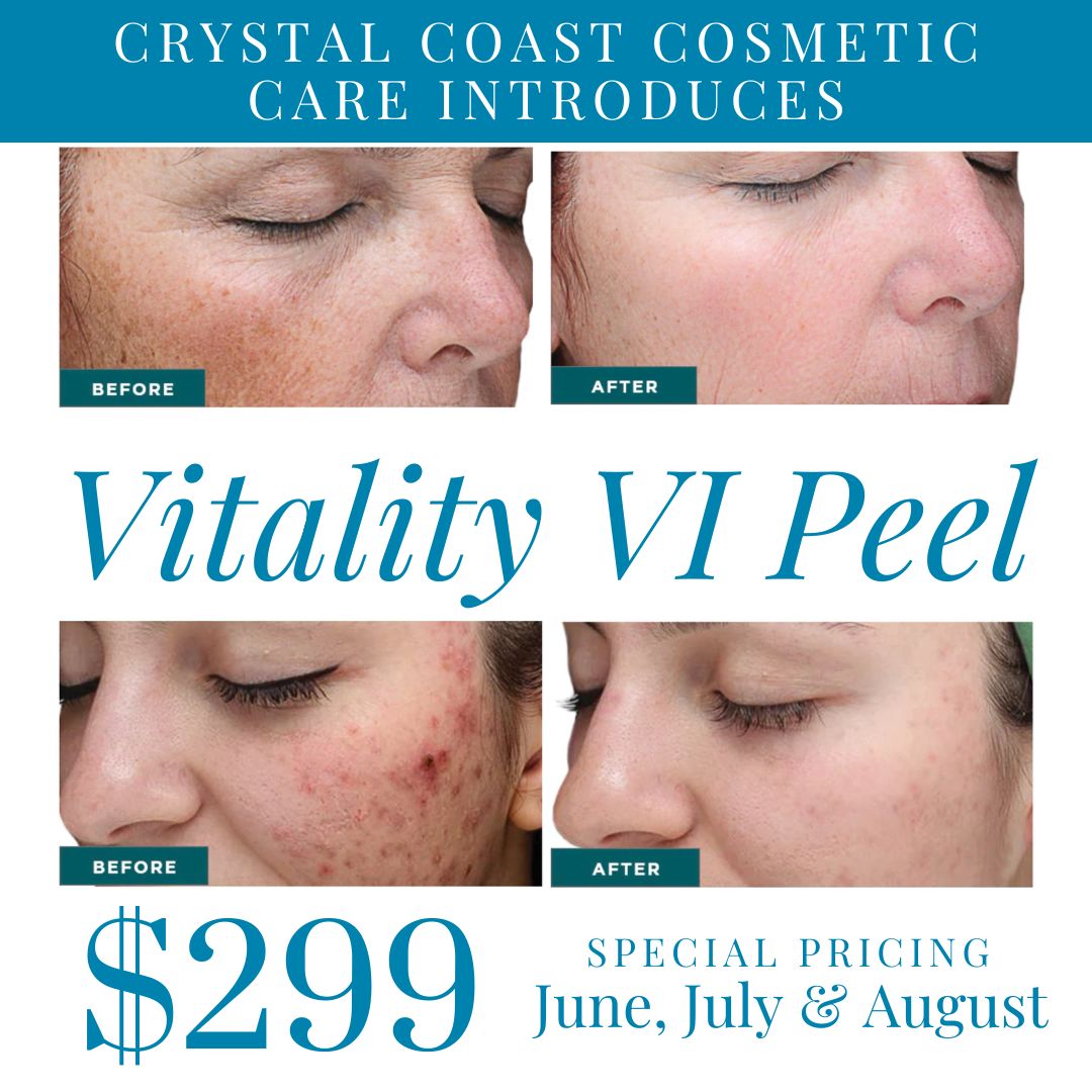 Vitality VI Peel - $299 Special Pricing in June, July, and August