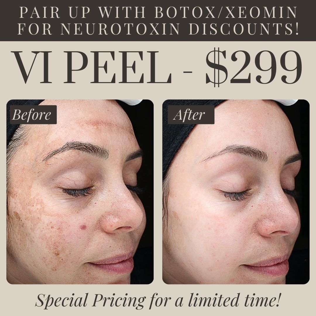 Vitality VI Peel